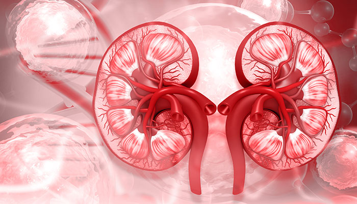 Chronic kidney disease